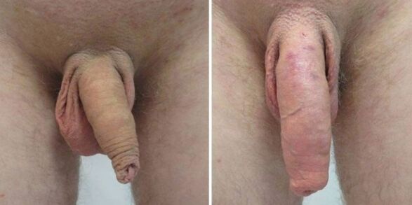 Penis pred in po obešanju uteži